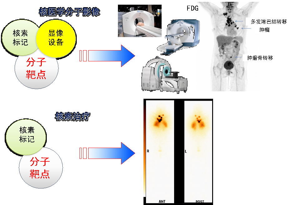 核医学是