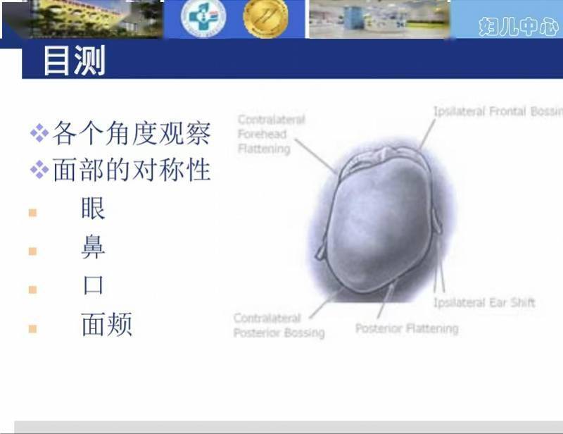 扁头,再到正规医院进行评估,由医生评估婴儿是否存在头颅形状不对称