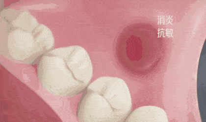 效果|又到火锅季，担心上火？降火神器了解一下