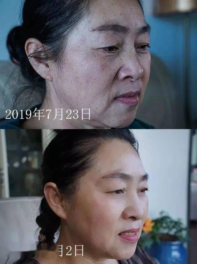 淋巴54岁李若彤无人敢娶?一张近照曝光真相,网友:这身子太飒了!