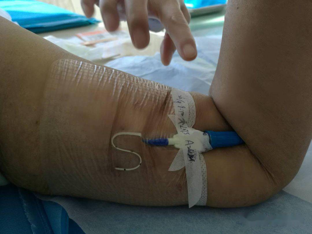 picc0揭敷料Ω固定法好经验快收藏