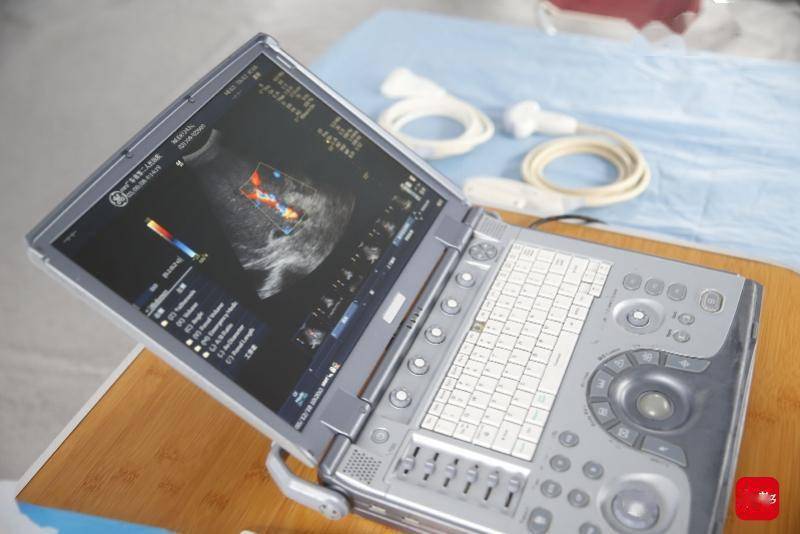 提速|移动卒中单元可开至社区，这个联盟为脑卒中血管疏通提速