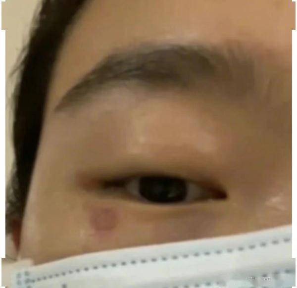 这种虫，是会飞的“硫酸”