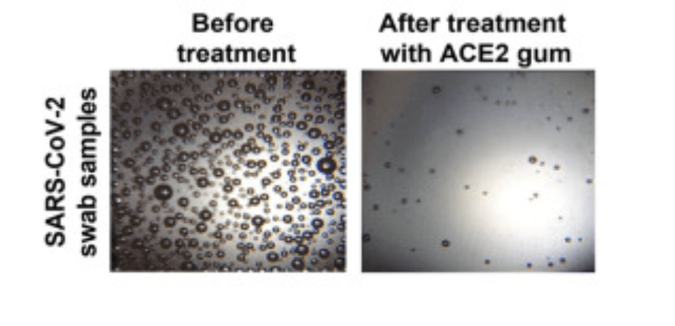 来，嚼可以“捕获”新冠病毒的口香糖