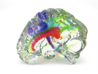 “3D打印技术+医疗”加速落地！将带来哪些利好？