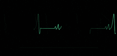 感觉|总感觉“心突突跳”是怎么回事？别忽视这些心脏的求救信号！