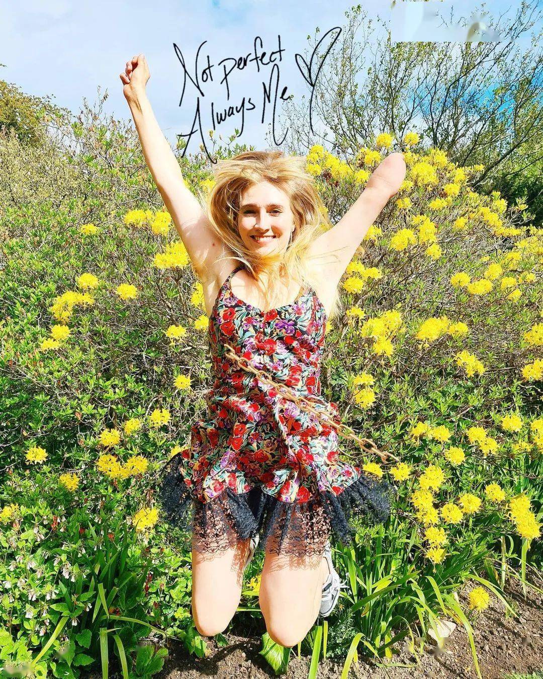 winnie harlow「我不相信榜样.