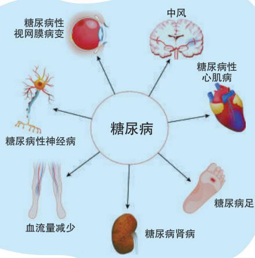 糖尿病几大并发症到底有多危险