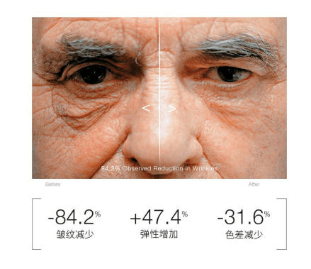 品牌值得买丨加拿大天王抗衰精华来也!这简直是魔鬼级淡皱纹熨斗啊