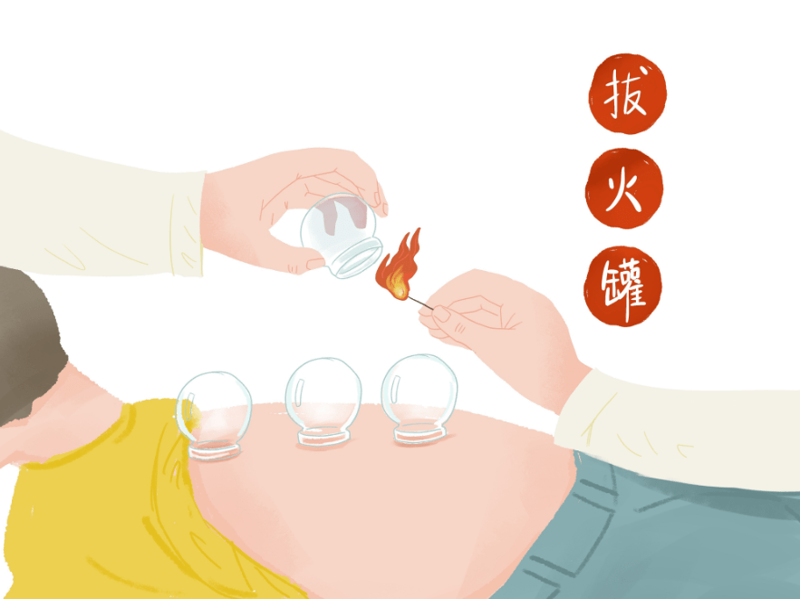 功能|冬天拔罐能提高免疫力吗？颜色越深寒气越重？听听中医怎么说