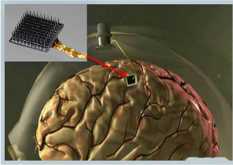 神经信号记录电极简介_犹他_皮层_阵列