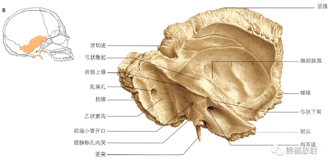 颧骨弓轴位图片图片