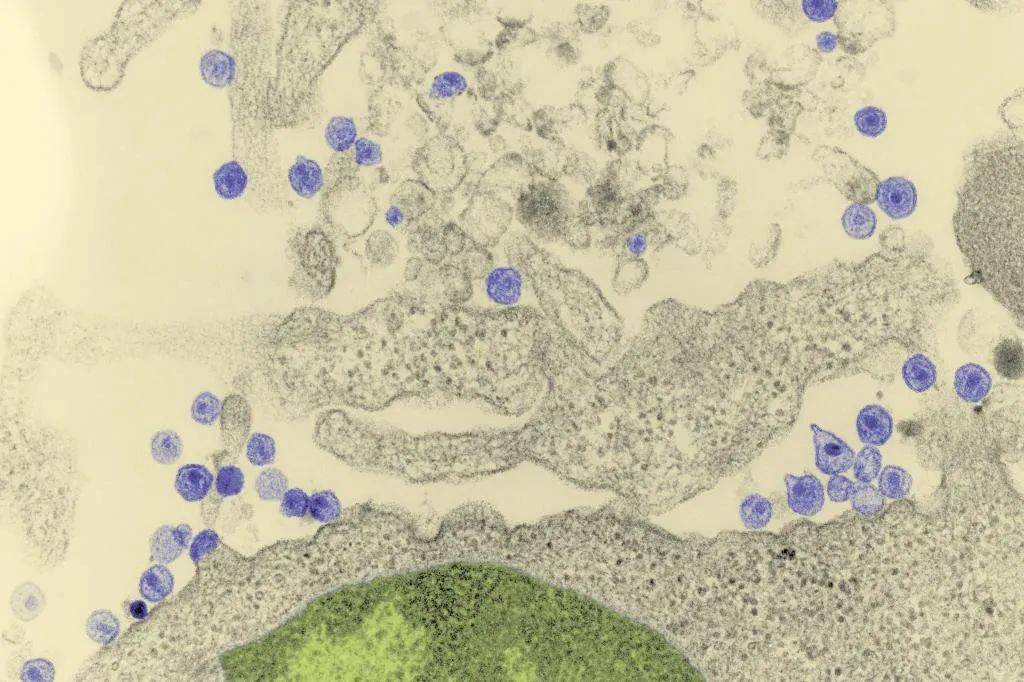 dauguet博士肩负着使用电子显微镜,从培养的细胞中找出逆转录病毒颗粒