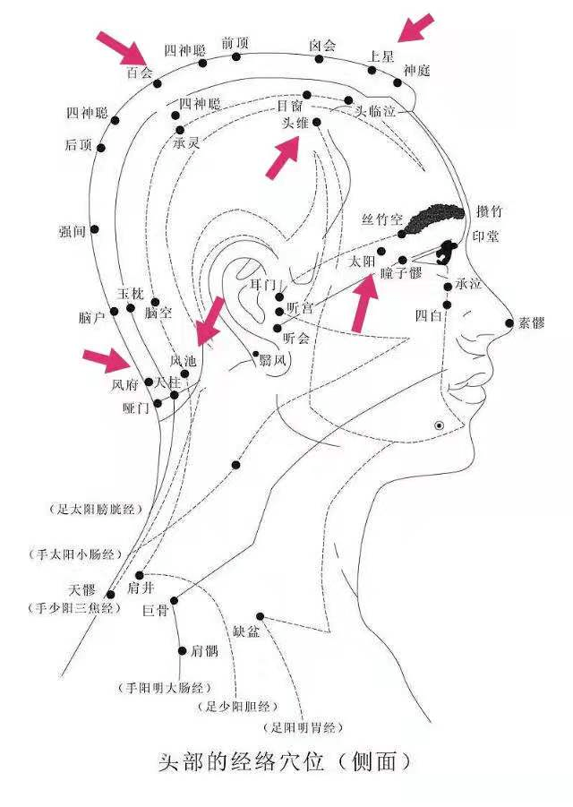 六经头痛位置图图片