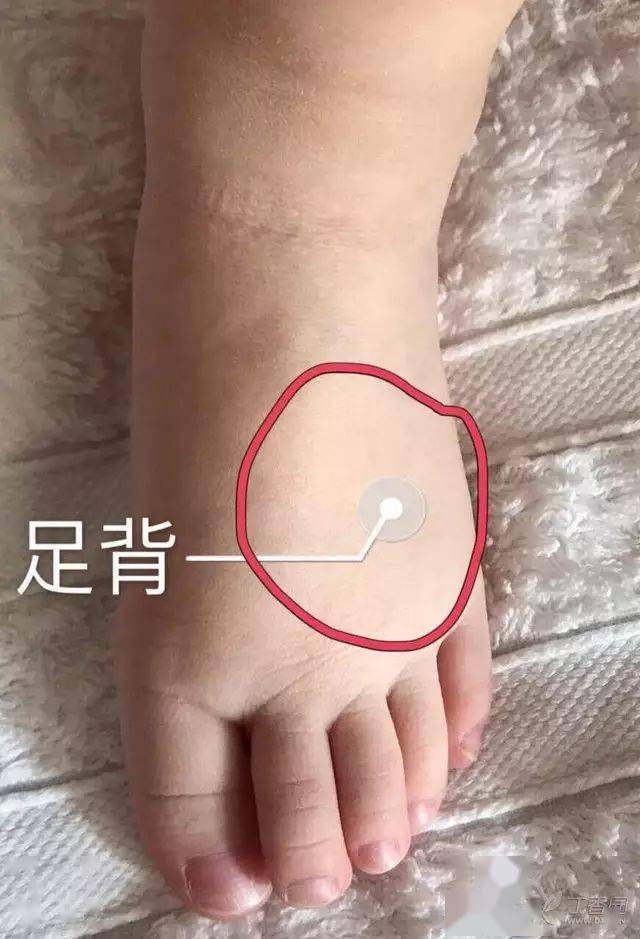 除了手腕原来还能在这些部位做皮试