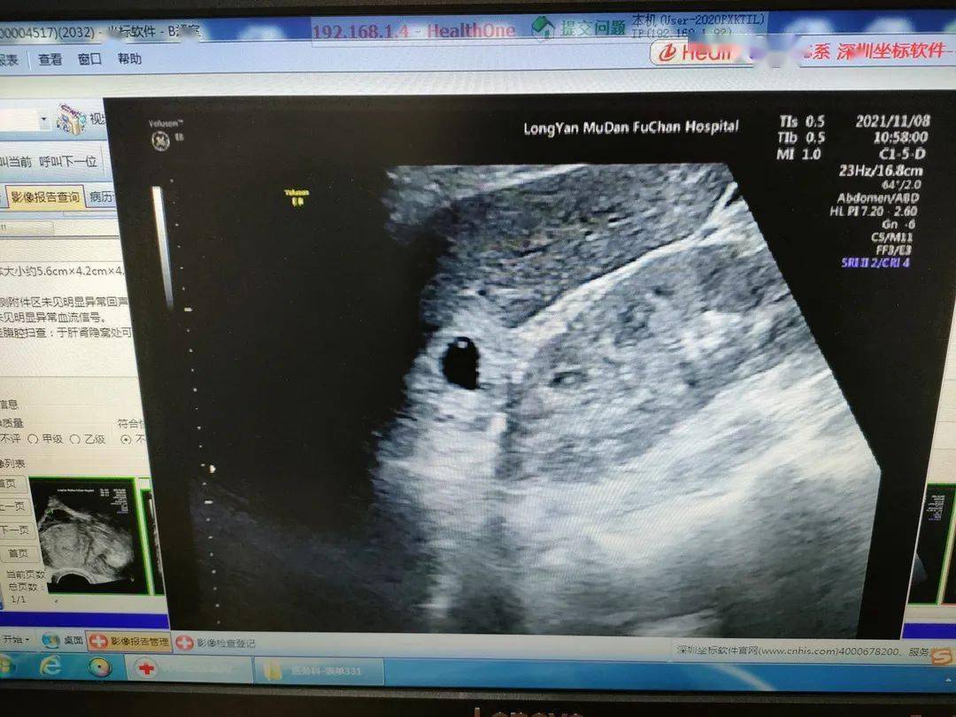 检测的结果是她怀孕了,查血hcg28315.