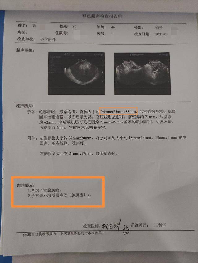 至重庆当地医院就诊检查彩超回示 子宫腺肌症并腺肌瘤