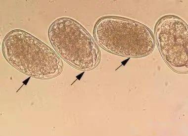东方毛圆线虫卵图片