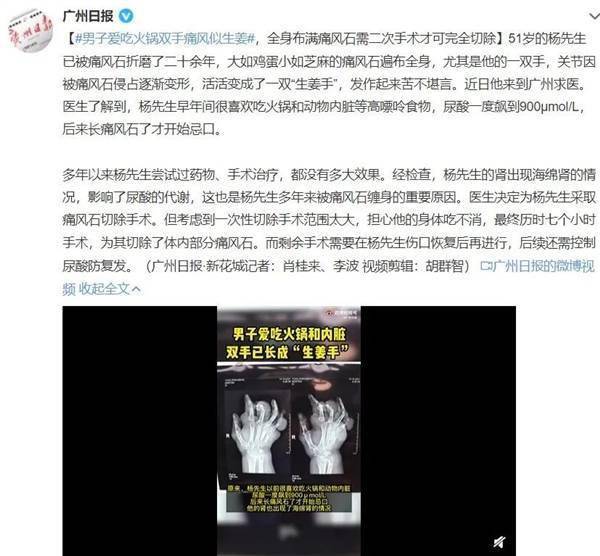 可怕!男子全身长满"石头:很多人都有这些坏习惯