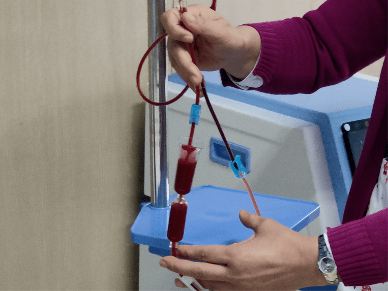 区人民医院首次引进三氧自体血疗法用自己的血治自己的病