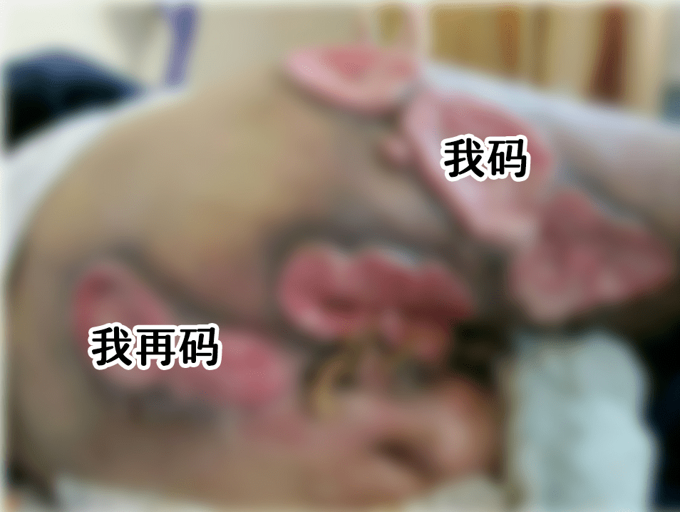 而且,和阴道偏酸性环境不同,直肠内的碱性环境更适宜于病毒生存繁殖.