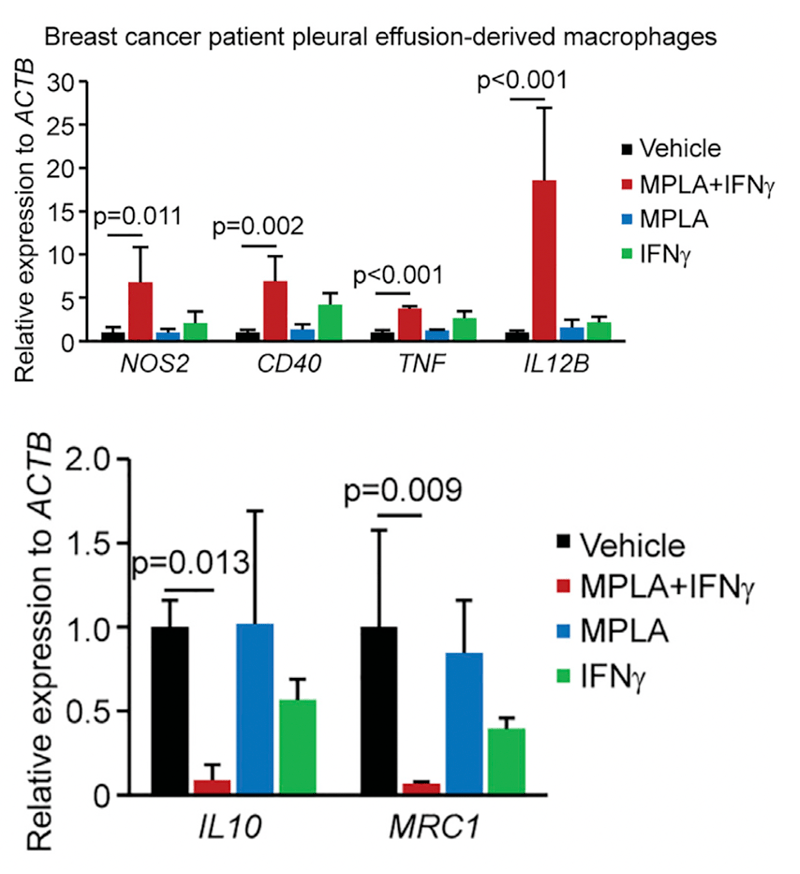 细胞|《细胞》子刊：让叛徒巨噬细胞回炉重造，两种老药提供新抗癌思路！