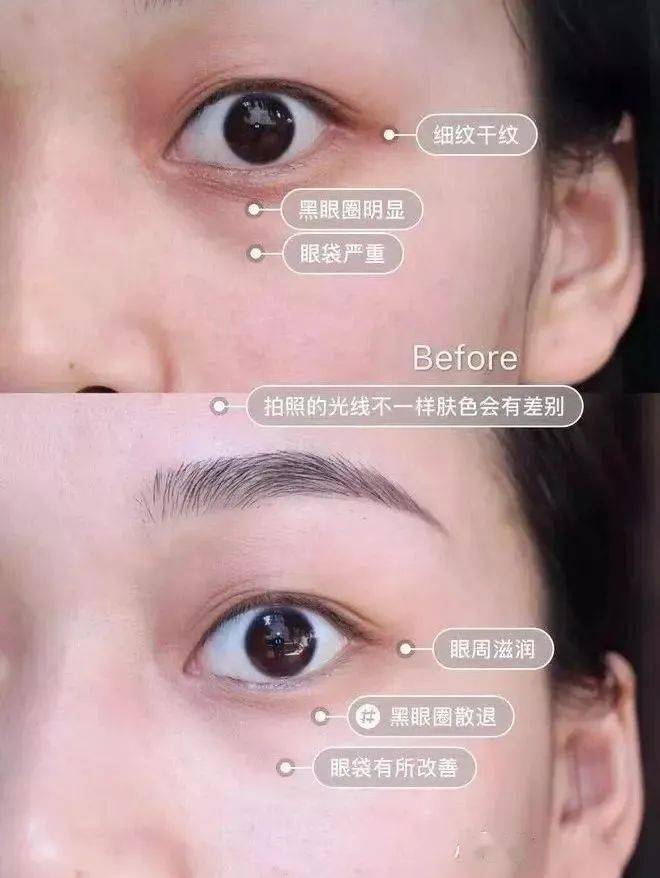 产品女人坚持喝它，肌肤白1度，色斑，暗沉通通消失，皮肤水嫩光滑，别怪我发晚了