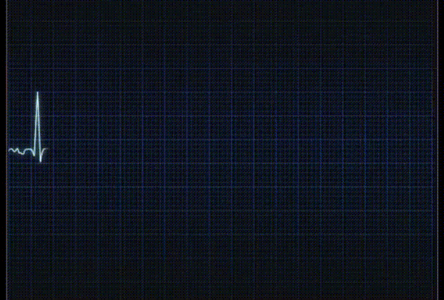 时隔三年！苹果手表「心电图」功能解锁，支持4款机型，快来看你的能不能用...