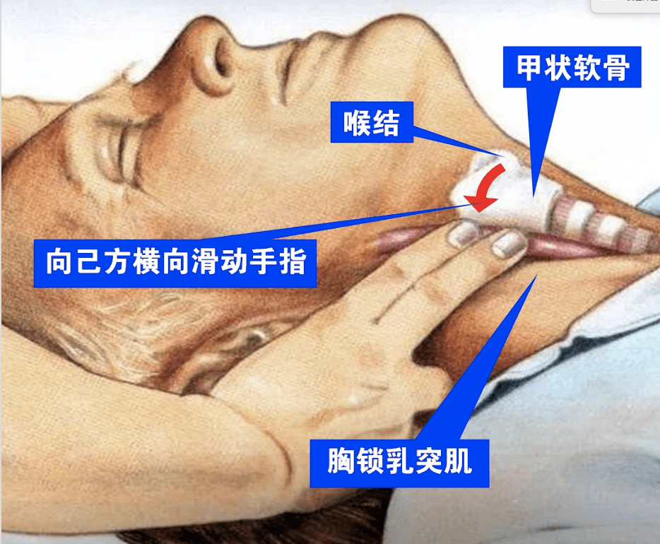 触摸颈动脉位置图片