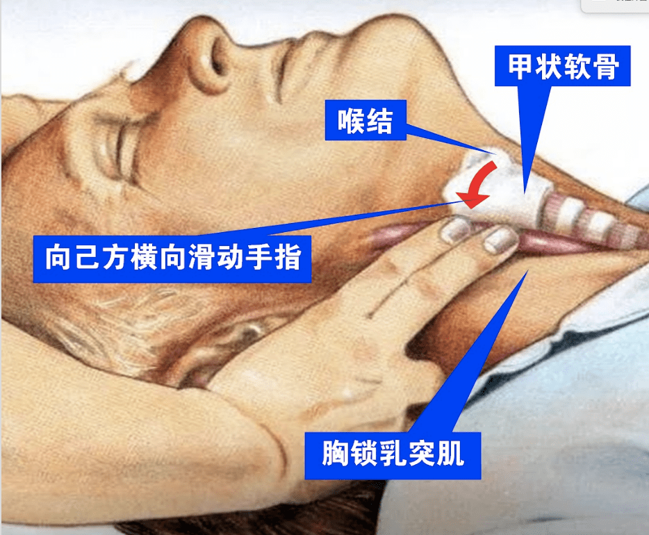 颈动脉触摸正确手法图片