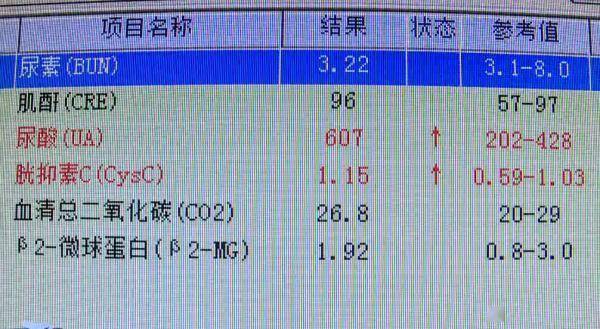 mol|每天喝十几瓶啤酒，一男子体内抽出“牛奶”