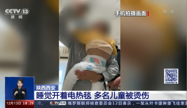 电热毯|多名儿童睡觉被电热毯烫伤 冬季如何防止“低温烫伤”？