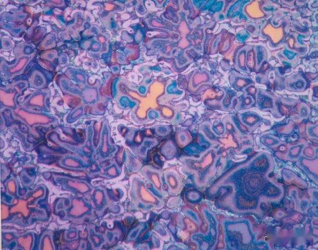 赶紧收藏！铝及铝合金高清金相图谱_系列_热处理_应用