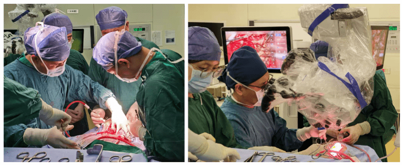 眩晕|复发颈动脉瘤“侵入”大脑引眩晕！多学科团队联手将其破拆