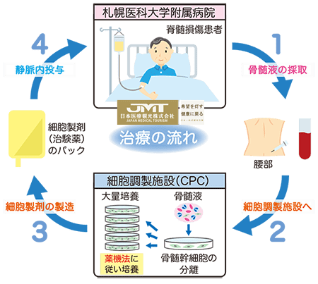 jmt日本干细胞治疗脊髓损伤脊髓损伤的日本干细胞治疗研究进展