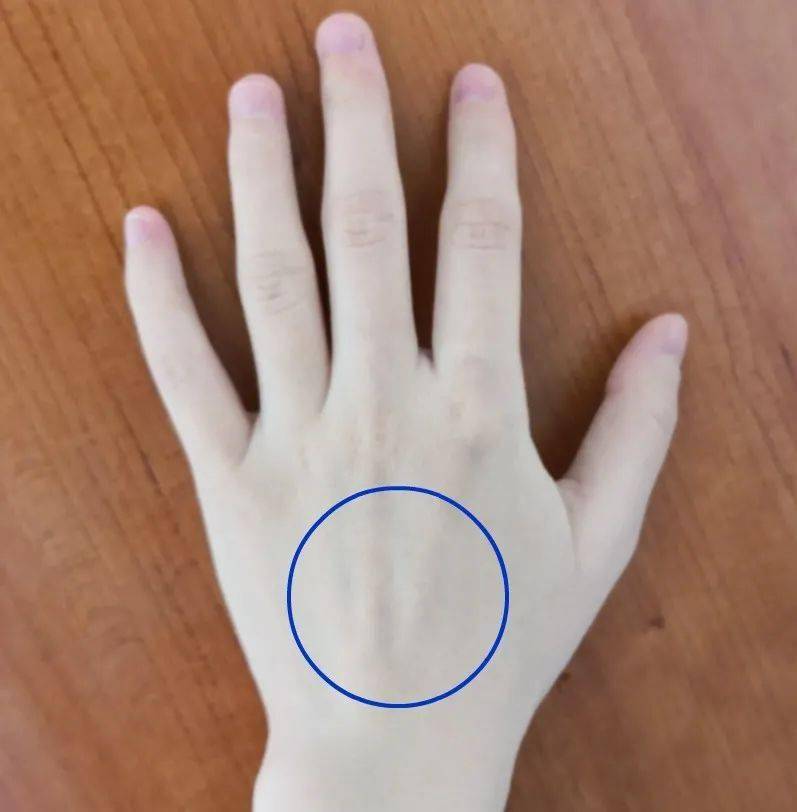 手上长青筋有可能是血管在报警,有这种情况要当心了!