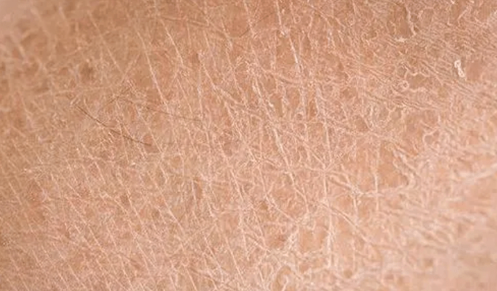 秋冬皮肤越补水越干燥这4个有效补水的方法值得收藏