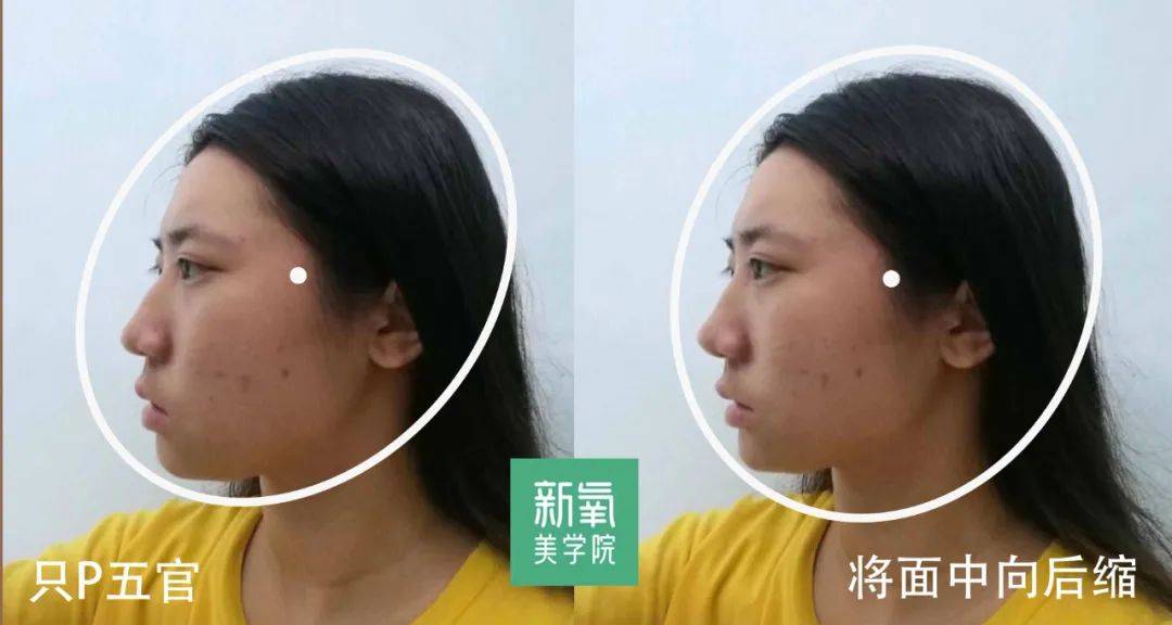 为什么范冰冰、刘诗诗扁头却依然五官立体?扁头一定就是睡出来的吗?_迪纳里克_头型_面型