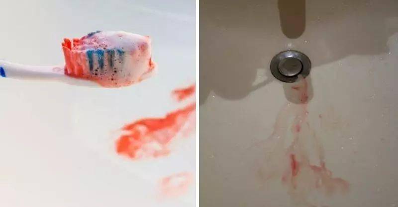 牙缝里|「牙齿橡皮擦」?一刷香口、黄渍消，二刷牙齿白如雪！