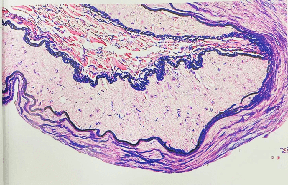 这就是病理世界里色彩的秘密~_染色_诊断_细胞