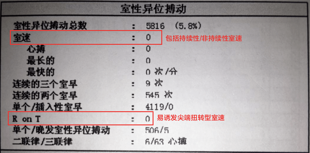 動態心電圖報告應該怎麼看