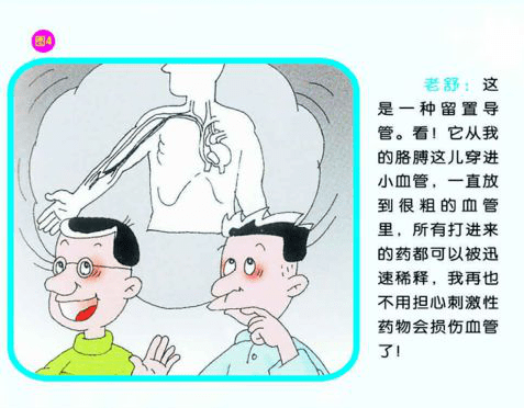 输液困难picc置管解难题