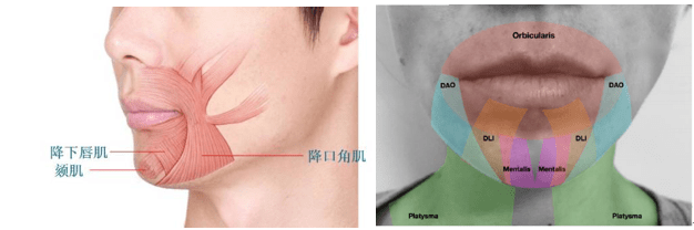 口角歪斜,通常发生在注射降口角肌,颏肌,颈阔肌的时候