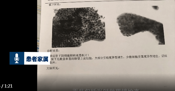 女子月经不调就医38天后死亡，死亡原因到底是什么？
