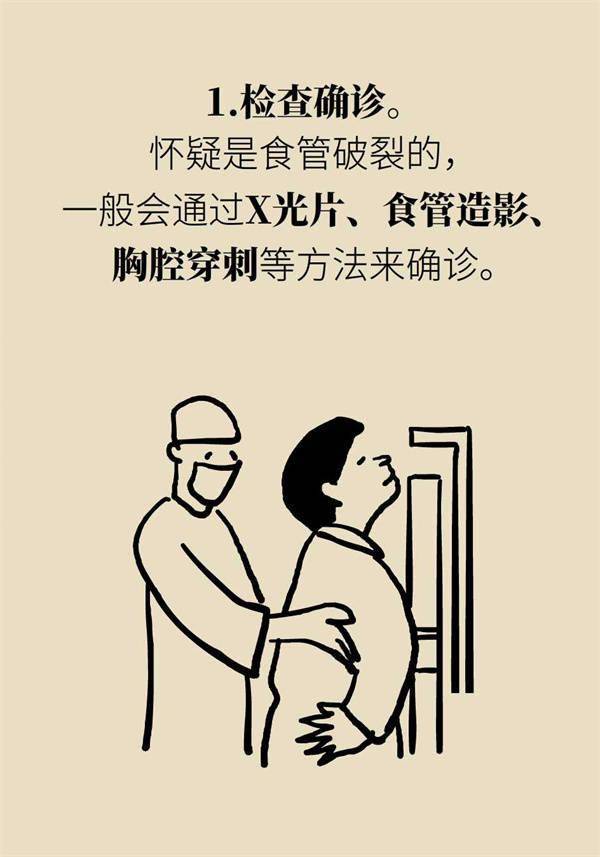 胡偉鵬|酒醉嘔吐有多兇險？警惕食管破裂！