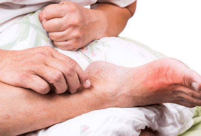 吃猪肉尿酸高怎么回事