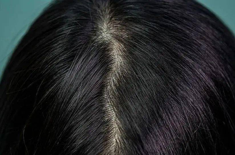 洗头“你的头发影响了你80%的颜值”：康王创始人87岁再出山，挑战5天不洗头！