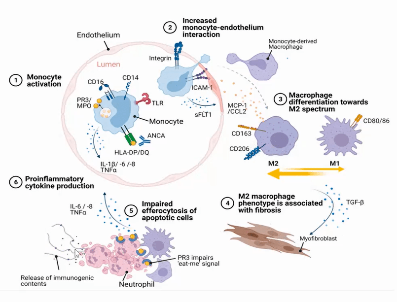系统性血管炎怎么治一文盘点2021权威指南更新