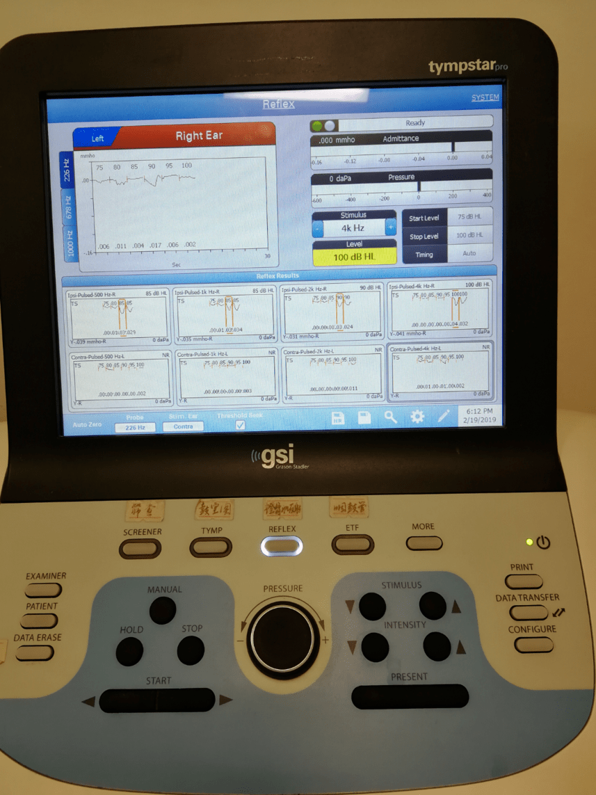 诊断型声导抗仪(含226hz 和1000hz探测音)诊断型听性脑干诱发电位仪