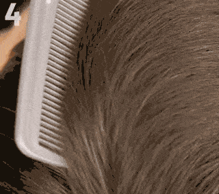 尸体头上抠下来的白泥竟是螨虫尸体!头痒头屑出油多,用它就对了